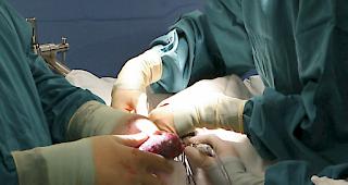 Die Warteliste der Kranken, die Organe ben&ouml;tigten, blieb im Vergleich zu 2016 praktisch unver&auml;ndert. (Archivbild)