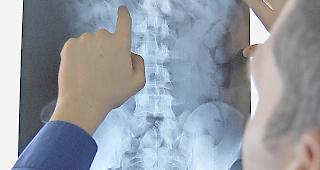 Mit R&ouml;ntgenbildern k&auml;mpfen die Beh&ouml;rden gegen Drogenschmuggler.