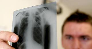 Gesundheitsbeh&ouml;rden hat im Umfeld des Jugendlichen rund 60&nbsp;Kollegen identifiziert, die sich angesteckt haben k&ouml;nnten. (Bild: R&ouml;ntgenaufnahme einer Lunge)