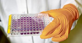 In der N&auml;hrfl&uuml;ssigkeit. In diesem Beh&auml;lter werden Zellkulturen gez&uuml;chtet.