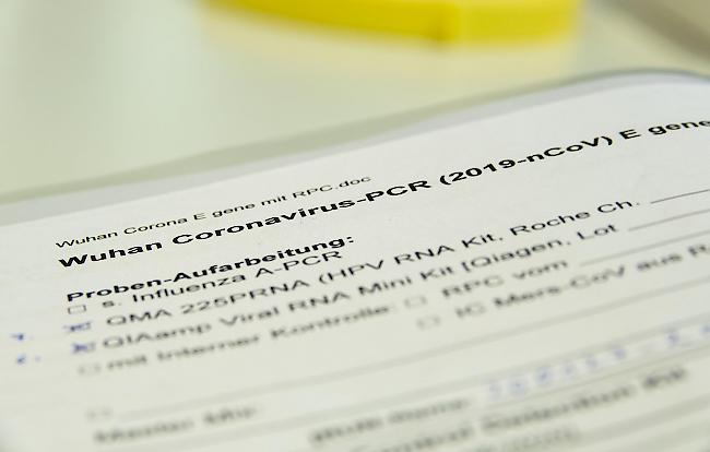Akte für Coronavirus-Verdachtsfälle in einem Labor des Landesgesundheitsamtes Niedersachsen (Hannover, 28. Januar 2020).